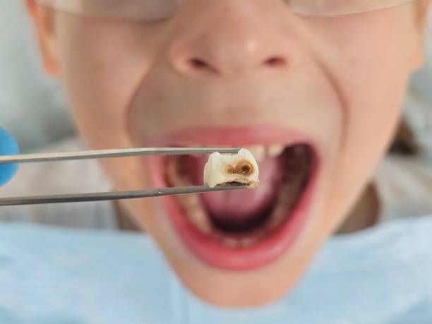 Best Emergency Gum Treatment in Prichard, AL